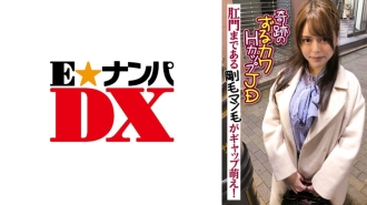 奇迹狡猾的卡瓦 H 杯 JD 毛茸茸的男人头发延伸到肛门是间隙萌 ！